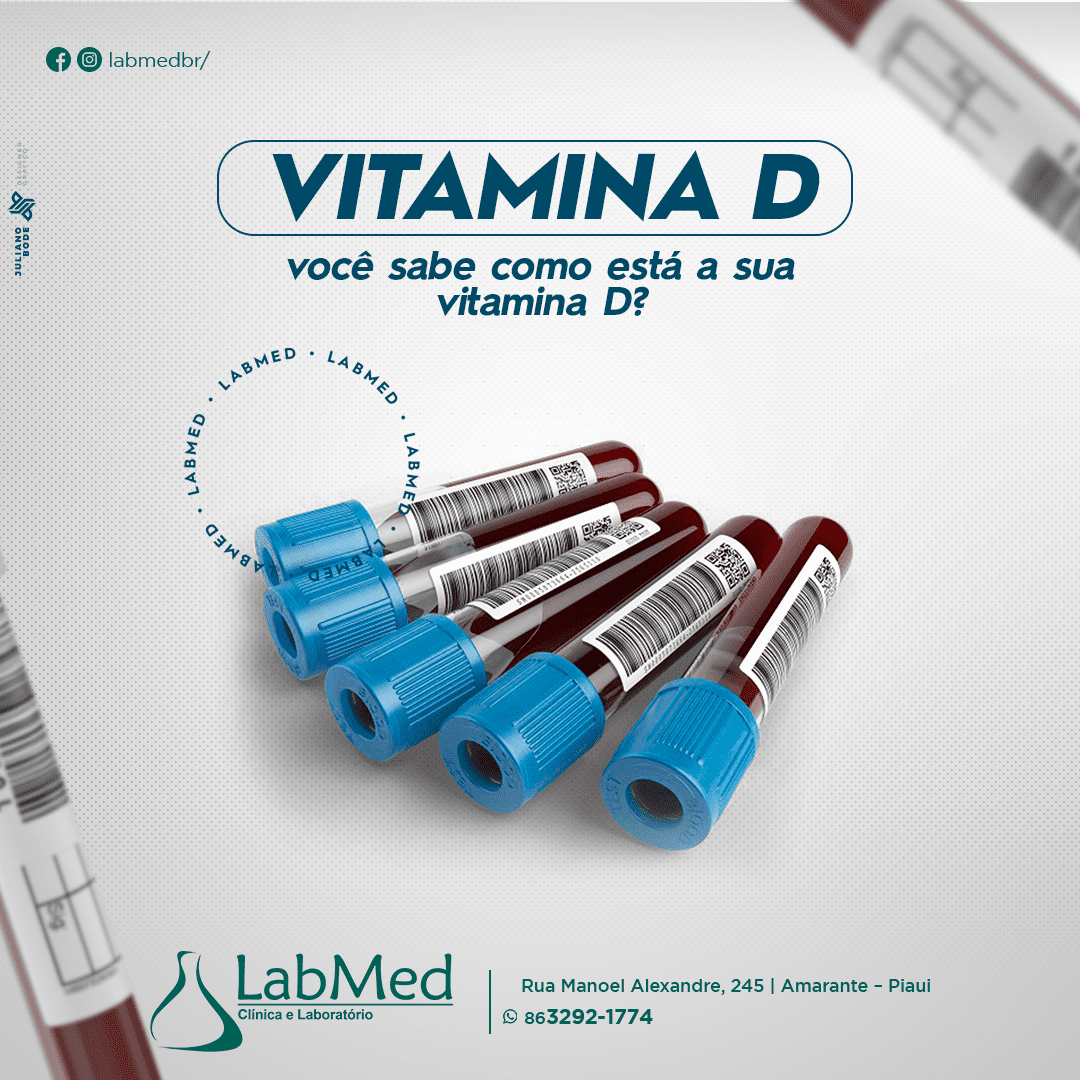 23 - -JUN - -VITAMINA-D-LAB-FEED